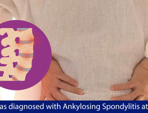 I was diagnosed with Ankylosing Spondylitis at 15