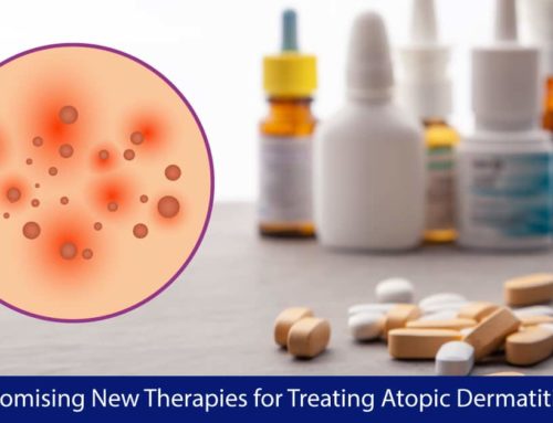 Promising New Therapies for Treating Atopic Dermatitis
