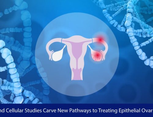Genetic and Cellular Studies Carve New Pathways to Treating Epithelial Ovarian Cancer
